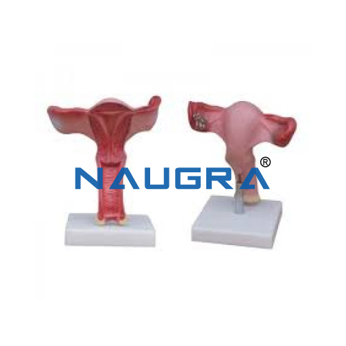 Magnified Uterus Model